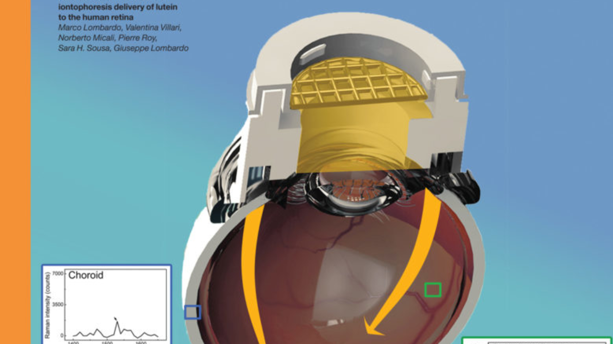 Front Cover: Assessment of trans-scleral iontophoresis delivery