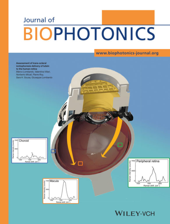 Front Cover: Assessment of trans-scleral iontophoresis delivery